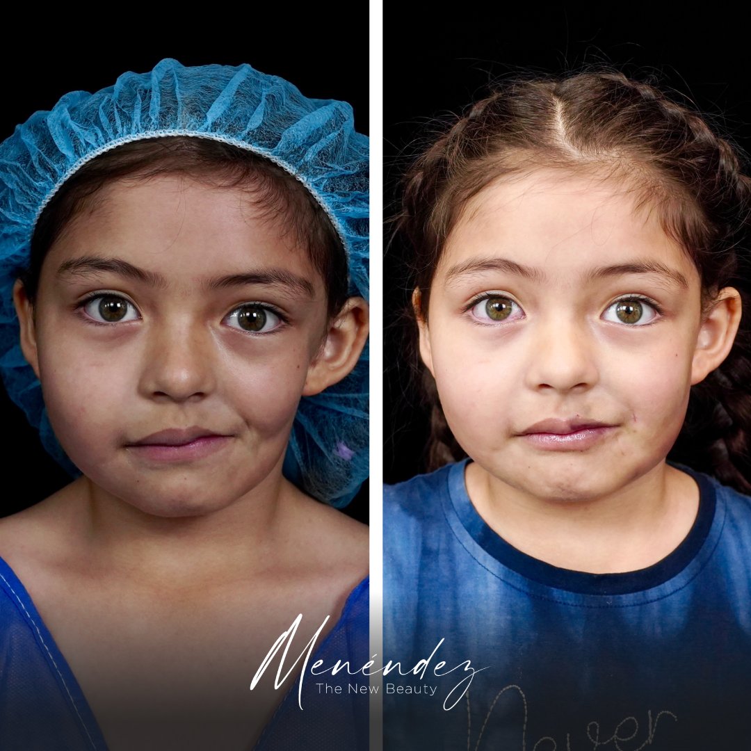 DrJPMenendez's tweet photo. #TheNewBeauty #FirstClassPlasticSurgery #CirugíaPlástica #CirugíaEstética
#BellaNovaClinic #Ecuador #FundacionMenendez https://t.co/mDoJrznOOr