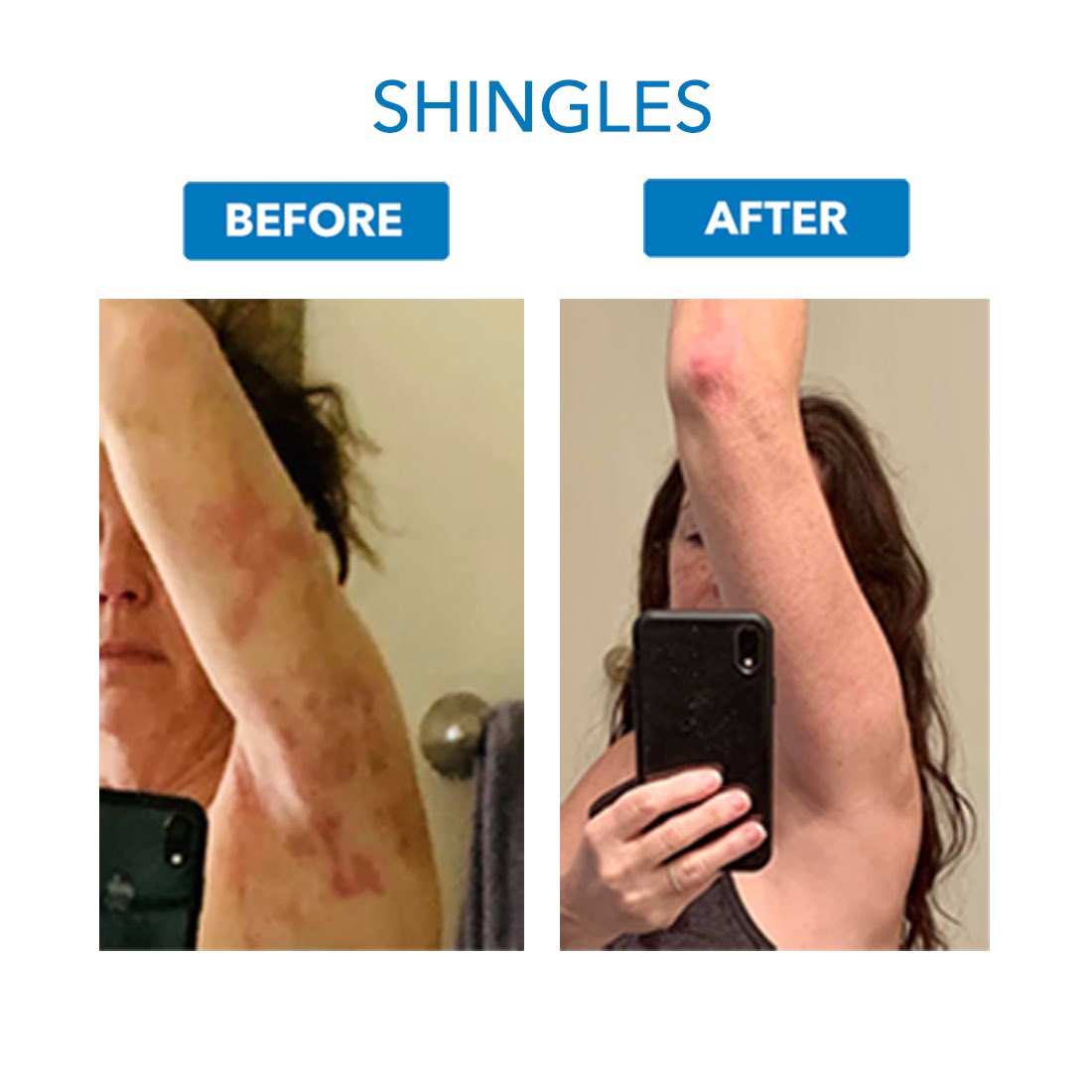 CBD4Pets's tweet photo. 24 HOUR #FLASHSALE!
Works on People AND Pets 🐶🐱😀
Amazing #CBD #Prebiotic Spray
#Eczema
#Shingles
#HotSpots
Limited supplies!
Don't take our word for it👇
SHOP-https://t.co/sBWapYJ0Fa
Split the cost into 4 payments INTEREST FREE!
#PetCBD #DogCBD #CatCBD #WoundCare https://t.co/VuCdlHMKns