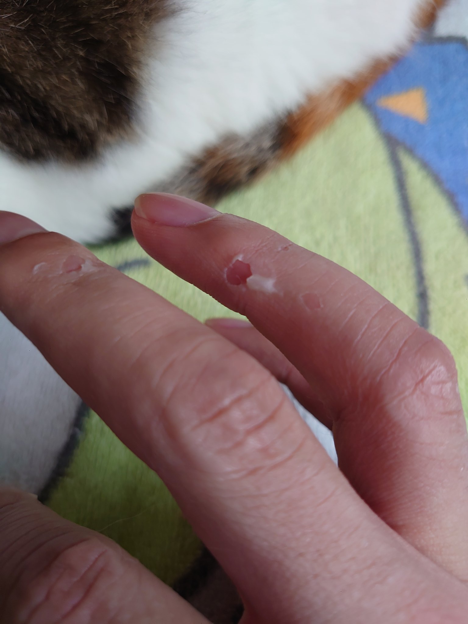 こう ゴム手袋をした手が蒸れて臭うのは手袋に穴が開いているのか 水ぶくれの薄皮が破けた中の汁が臭いのか T Co Ueyiqlcxxs Twitter こう ゴム手袋をした手が蒸れて臭うのは手袋に穴が開いているのか 水ぶくれの薄皮が破けた中の汁が臭いのか T Co Ueyiqlcxxs Twitter