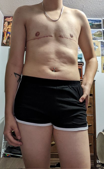 Sooo I bought the shorts.. I think they make me look pretty hot #nsfw #nsfwtwt #nsfwtw #shorts #nude<a href="/tag/selfie"class="tags"><span>#selfie</span></a><a href="/tag/hot"class="tags"><span>#hot</span></a><a href="/tag/shorts"class="tags"><span>#shorts</span></a><a href="/tag/nude"class="tags"><span>#nude</span></a><a href="/tag/nsfw"class="tags"><span>#nsfw</span></a><a href="/tag/trans"class="tags"><span>#trans</span></a><a href="/tag/ftm"class="tags"><span>#ftm</span></a><a href="/tag/transman"class="tags"><span>#transman</span></a>