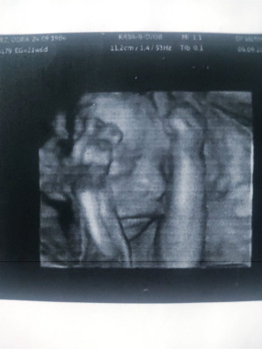 elviscreator's tweet photo. Quiero compartir esta foto del principito que sigue creciendo en el vientre de mi esposa. Su primera foto!! 

Les presento a Zabdiel Villanueva, nuevo heredero , guerrero de la nueva generación de la #gmmarmy , futuro holder del token $GMM del Metaverso de @Gamiumcorp !

😍♥️ https://t.co/wu6PVyJRrg