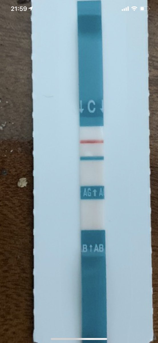 KIMMINH21874884's tweet photo. Xét nghiệm #HIV tại nhà cùng với Mylan HIV Self test .
Giá sale chỉ 100.000₫
Đặt test HIV, #PrEP, #PEP: 0911339260 (Kim Minh).
Ship Hỏa tốc HCM và HN. https://t.co/29rkv7EB9m