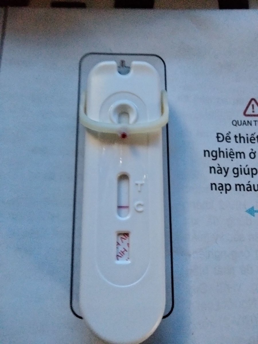 KIMMINH21874884's tweet photo. Xét nghiệm #HIV tại nhà cùng với Mylan HIV Self test .
Giá sale chỉ 100.000₫
Đặt test HIV, #PrEP, #PEP: 0911339260 (Kim Minh).
Ship Hỏa tốc HCM và HN. https://t.co/29rkv7EB9m