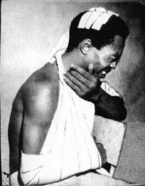 NigeriaStories's tweet photo. Fela Kuti was arrested over 100 times and made to appear in court over 258 times for criticising the corrupt activities of the Nigerian Government.

Some pictures of him after he was beaten and hospitalized https://t.co/WRg8MdqaRT