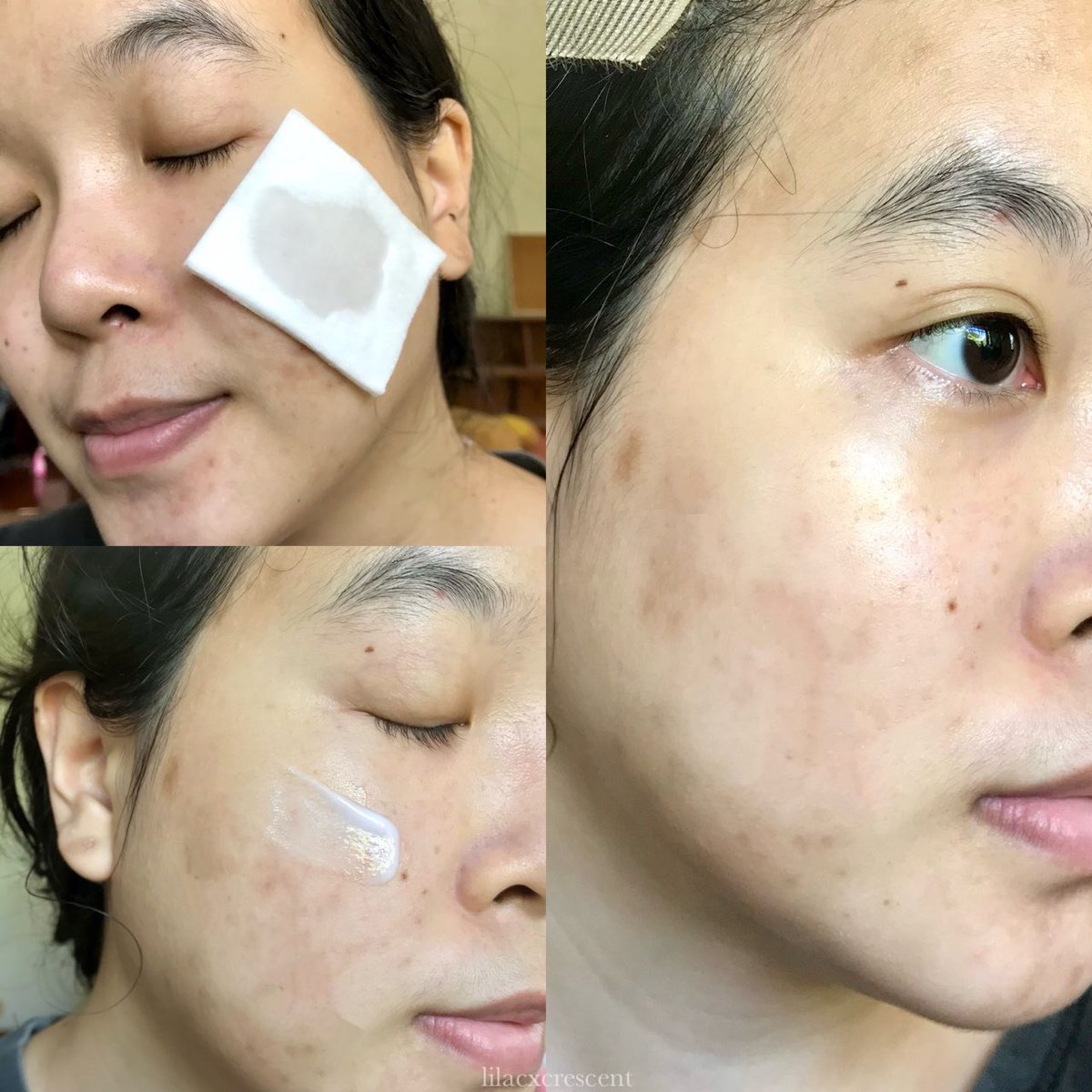 ได้มาลองใช้เซ็ตคู่นี้แล้ว ชอบมากจนขอบอกต่อ🫶🏻 เซ็ตคู่ที่เราใช้ก็คือ Toner &amp; Emulsion ของ Farmskin เลย💓 ใช้แล้วผิวนุ่มชุ่มชื้น ช่วยฟื้นฟูผิวได้ดีสุดๆ และยังหอมกลิ่นแตงโม ไม่ทิ้งคราบ รู้สึกสดชื่นแบบสุดๆ ชอบมาก🤍🍉
#โทนเนอร์น้ำตบแตงโม #อิมัลชั่นแตงโม
#BTFarmskin #WatermelonToner