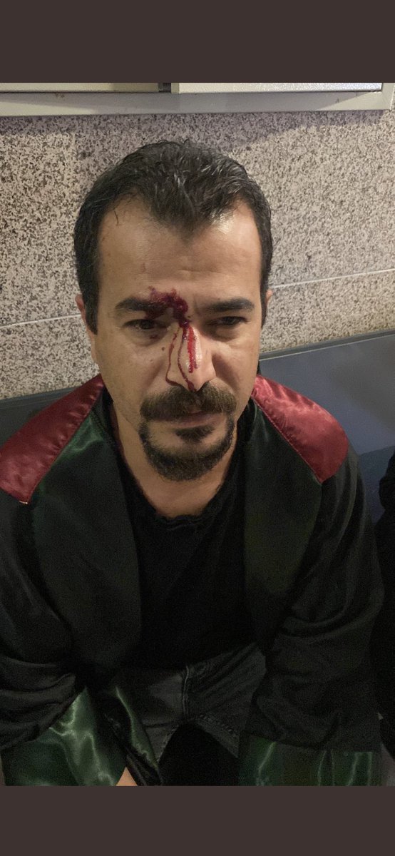 GulayOzgokce's tweet photo. Avukatlar taraf değildir, meslektaşımız Av.Cahit Ertan’ a yapılan bu çirkin saldırının takipçisiyiz. Avukata dokunma#savunmaya dokunma! https://t.co/eLxh5hWasm
