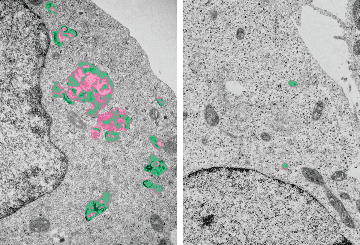 Check out the new publication in @ScienceMagazine of our member Sabrina Jabs @kieluni and colleagues. They identified a formerly unknown key protein in #lysosome biogenesis that is relevant for inherited disease and viral infection. @UKSH_KI_HL precisionmedicine.de/en/details/new…