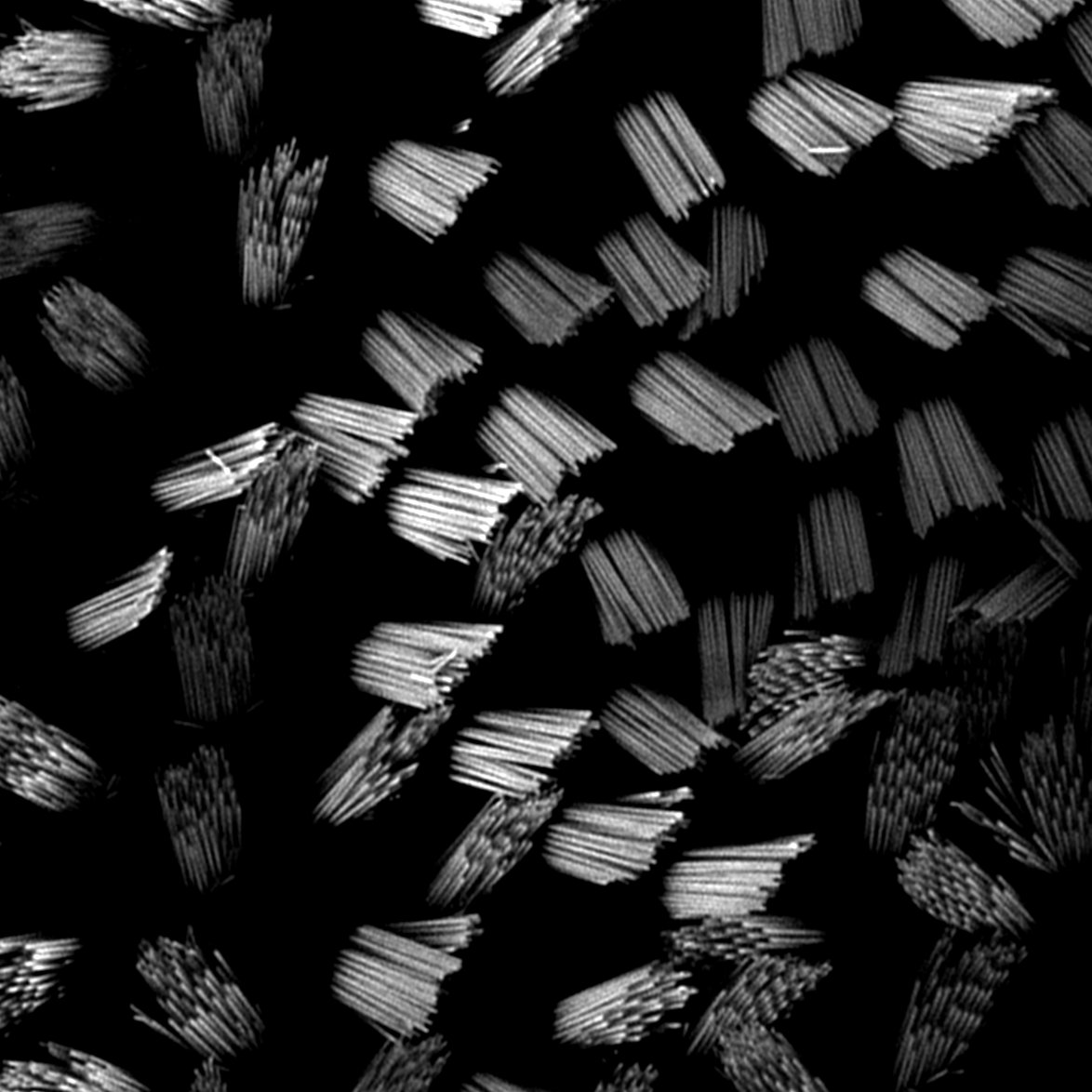 Zoe Mann (@zfm31) on Twitter photo SiR-actin labelling in live hair cells
Image - James O'Sullivan
<a href="/zeiss_micro/">ZEISS Microscopy</a> <a href="/CCRB27/">Centre for Craniofacial & Regenerative Biology</a> SiR-actin labelling in live hair cells
Image - James O'Sullivan
<a href="/zeiss_micro/">ZEISS Microscopy</a> <a href="/CCRB27/">Centre for Craniofacial & Regenerative Biology</a>