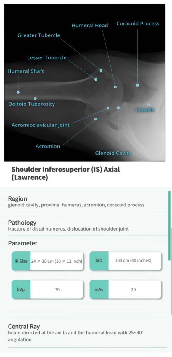 alnasser87's tweet photo. Navi Radiography
تطبيق ممتاز يساعد المبتدئين وغيرهم في أقسام الأشعة السينية على معرفة جميع الفحوصات من وضع المريض للفحص، وضع جهاز الأشعة، الاناتومي، باثولوجي، صور الأشعة للمنطقة المراد تصويرها وغير ذلك .. مفيد 👍🏻 https://t.co/TJcbmT3BiK