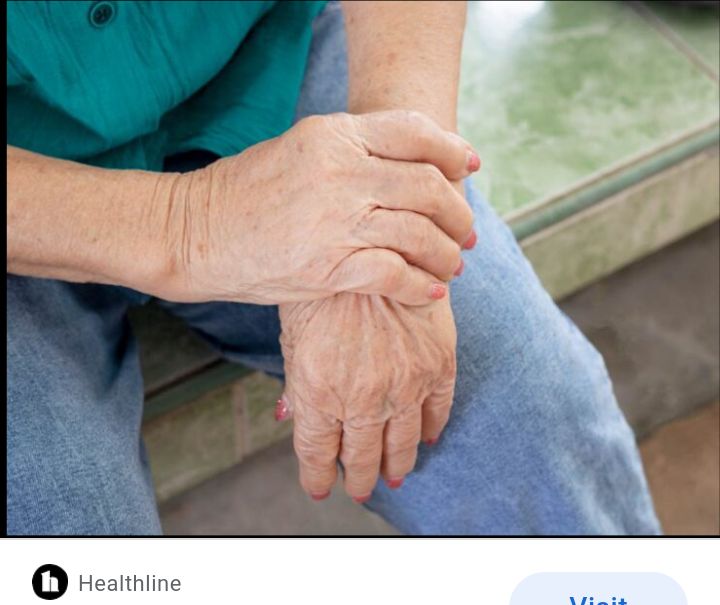 DrNIT5's tweet image. BERIBERI (THIAMINE DEFICIENCY)

BERIBERI, also known as Thiamine deficiency, is a disease in which the body does not have enough Vitamin B1 (Thiamine). It is usually caused by poor dieting or alcoholism.
#beriberi
#thiaminedeficiency