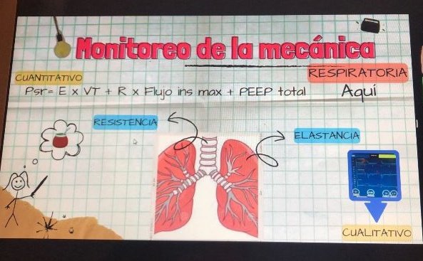 Ayer a la noche en el <a href="/cskcipsati/">CKI Pediátrico</a> de <a href="/SATIarg/">SATI</a> vimos un #temazo
👇
Monitoreo de la mecánica respiratoria en ucip y ucin

#kinesio
#monitoreo
#altoTEMA
#PedsICU 

<a href="/PallarolaP/">Paulita Pallarola</a> <a href="/MaxidSanchezok/">Maxi Sanchez</a> <a href="/sara_longoni/">Sara</a>