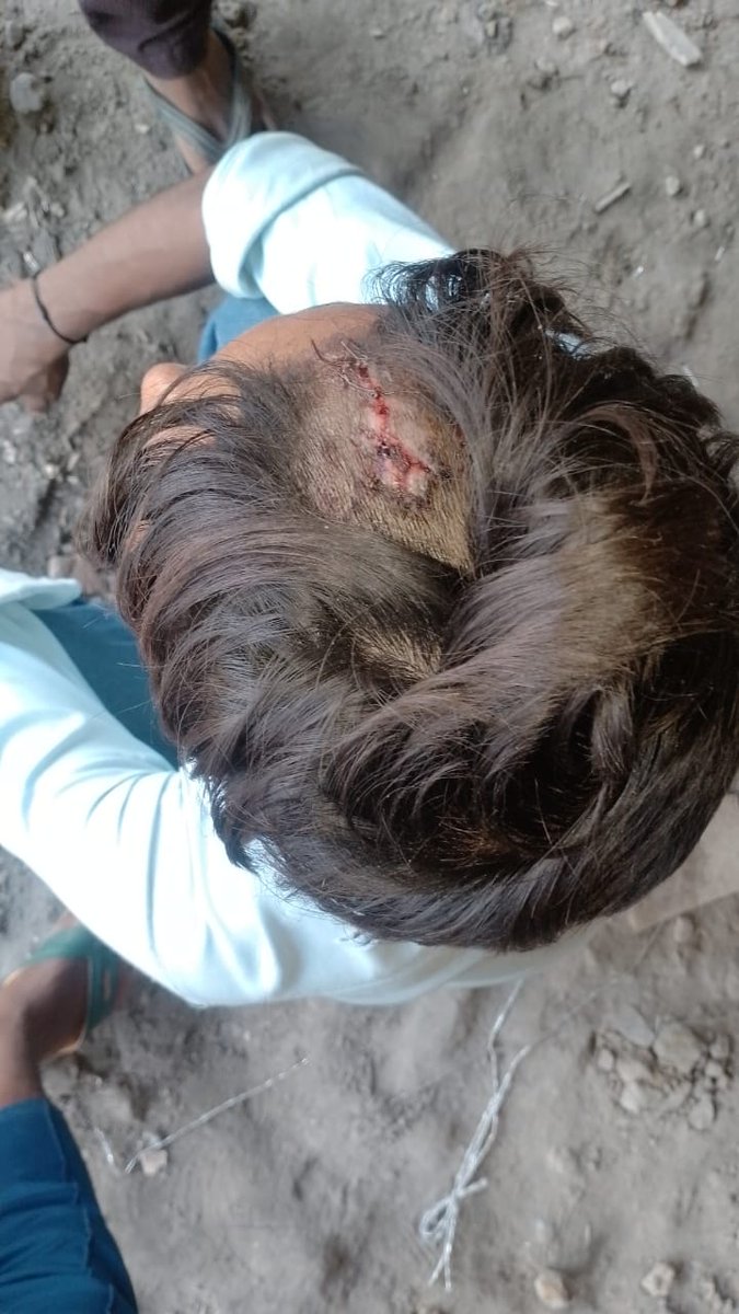 Aadarshujala's tweet photo. #बरखेड़ा क्षेत्र में दबंगों के हौसले बुलंद, दबंगों ने घर में घुसकर महिला और उसके बेटे के साथ की मारपीट। बरखेड़ा पुलिस को दी मामले की तहरीर पुलिस ने नहीं लिखा अभी तक मुकदमा। दबंगों के हौसले बुलंद @Uppolice @igrangebareilly @adgzonebareilly @dgpup @wpl1090 @pilibhitpolice https://t.co/RmJ8HZaWO3