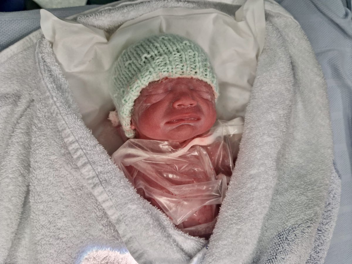 deinel1989's tweet photo. Our teenie weenie preemie is ONE!! 😳💜
Happy 1st birthday to the strongest little girl we know!! 💪🏼 Mummy, Daddy your brother and sisters love you so much!!! Hope you have an amazing day 🎁🎉🎈 https://t.co/65JPdUw8LV