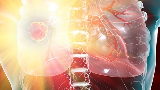 DeceraClinIns's tweet photo. Join us on September 28 for targeting NSCLC with EGFR exon 20 insertions. Dr. @JSabari  will discuss current treatment protocols. Register Now! https://t.co/4UlAYzGz2L #oncology #nsclc https://t.co/F6e3egNMkg