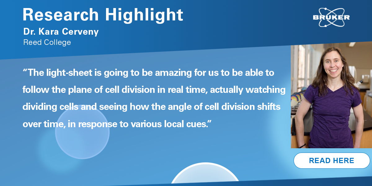 Our next #ResearchHighlight features @kara_cerveny, Associate Professor of Biology @Reed_College_. Dr. Cerveny discusses her experimental objectives using the light-sheet fluorescence microscope to study zebrafish eye development. Read: goto.bruker.com/3DcT9xy #lifesciences