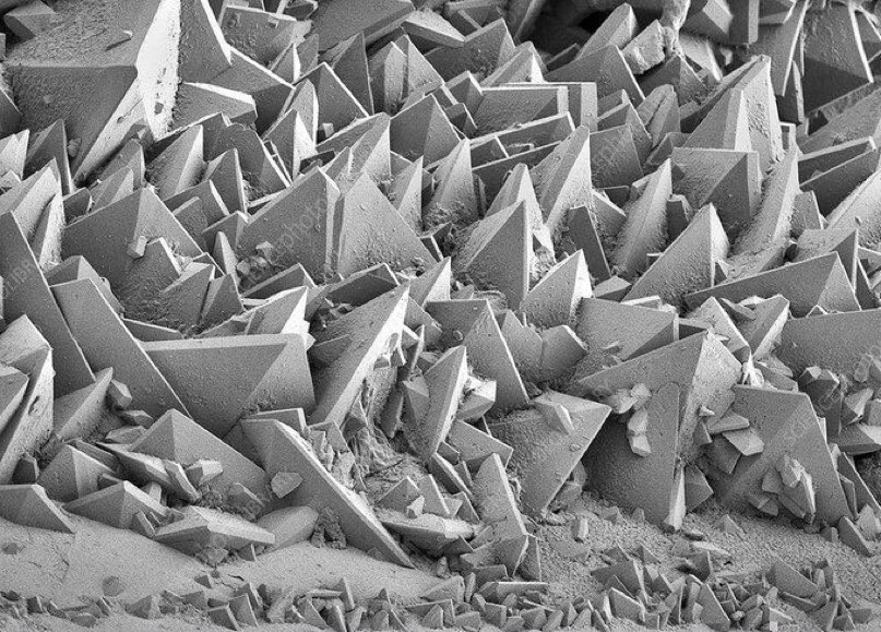 Avraham Z. Cooper, MD 🩺 (@avrahamcoopermd) on Twitter photo This is what a kidney stone looks like under an electron microscope 🤯
Via <a href="/microscopicture/">microscopic images.</a>
#MedTwitter This is what a kidney stone looks like under an electron microscope 🤯
Via <a href="/microscopicture/">microscopic images.</a>
#MedTwitter