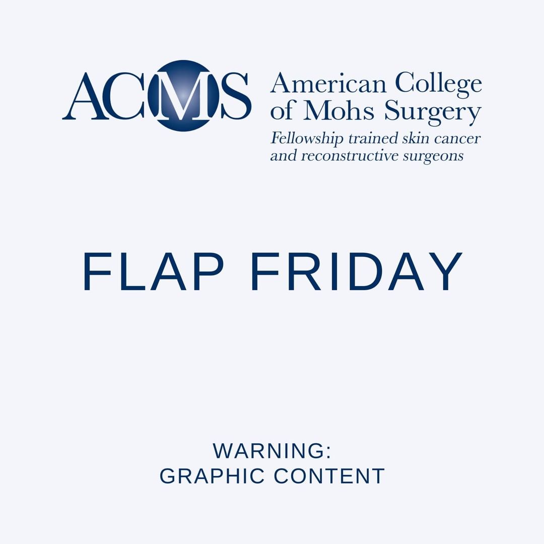 MohsCollege's tweet photo. Flap Friday Part One: This patient had a basal cell carcinoma on the left ala all the way to the rim. Reconstruction considerations include respect for the free margin and recreation of the convex alar surface. How would you repair this? #flapfriday https://t.co/nTLHXMrZAt