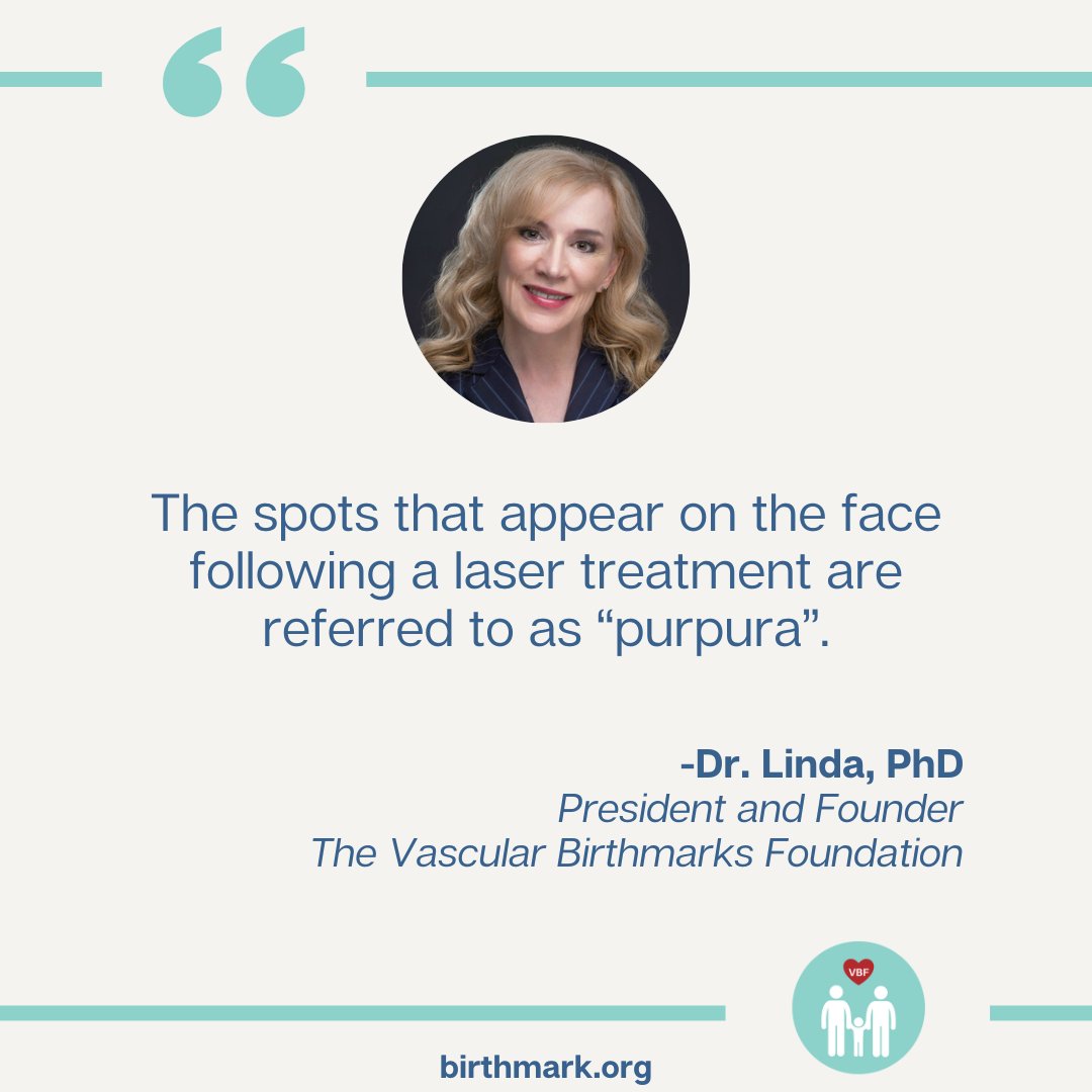 VBirthmarks's tweet photo. Dr. Linda's #VBF Fact of the Week!
#purpura #lasertreatment #vbffactoftheweek #vascularbirthmarksfoundation #FridayFacts #FactFriday #VBARS #ExpertInsights #ThoughtLeaders #ThoughtLeadership #FactsMatter #VascularBirthmarks #VascularBirthmarksAwareness #vascularanomalies https://t.co/uLLomuQjQK