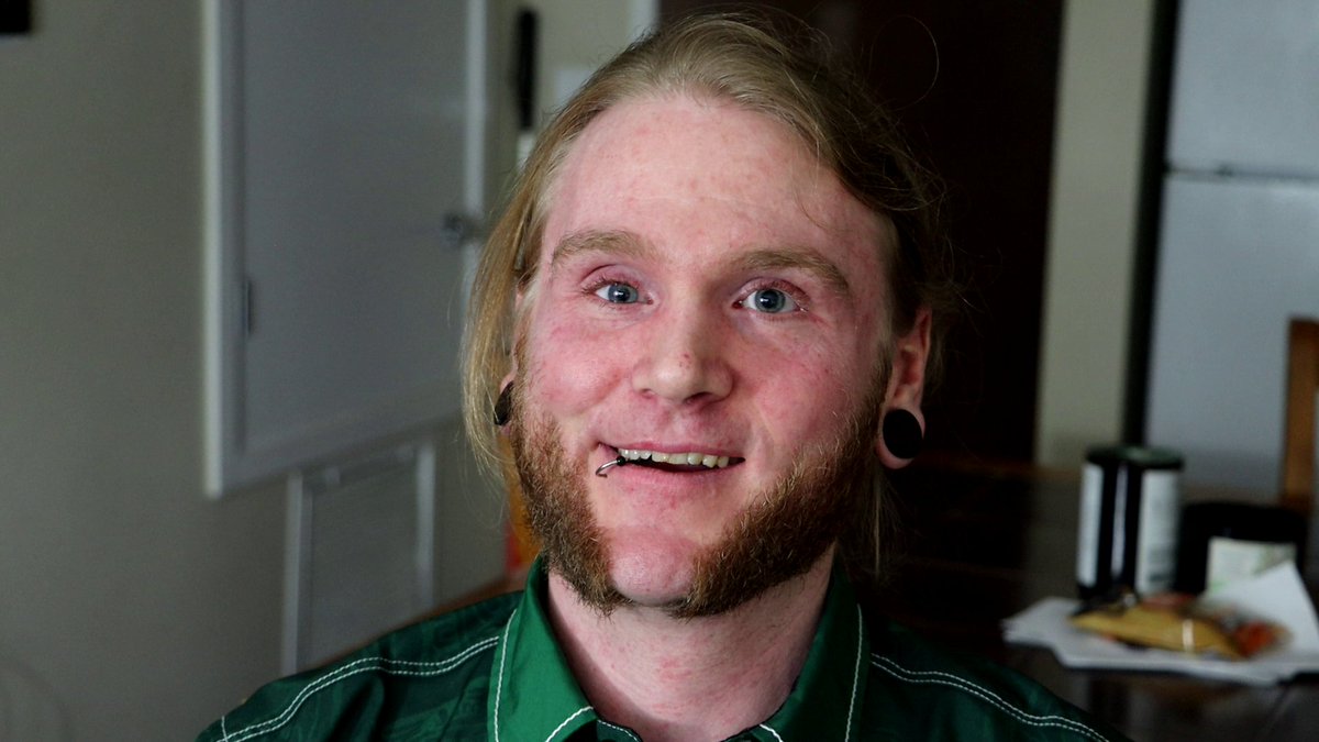Mark's survived a self-imposed and intentional bullet to the brain and woke up blind months later. Years later he realized he had repressed the memory of being trafficked as a child and has been in therapy ever since. You can watch his interview at youtu.be/L0Fpa_-KqlY