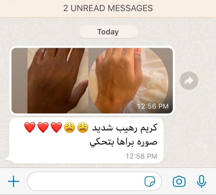 shineandglowcos's tweet photo. سحب على كريم الجسم " كريستال بودي"

تفتيح، ترطيب عميق، توحيد لون الجسم بالكامل، ازالة اثار الجسم و الجروح و الضربات مع الاستمرار، نضارة نضااارة نضارة و بشرة مشرقة جدا 😍🔥

الشروط:

ريتويت
فولو للاكاونت
منشن لي صحبتك
ختي لينا ♥️ في كومنت

لو ردينا عليك ب ♥️ انتي الفايزة معانا ♥️ https://t.co/ndl5rH06sw