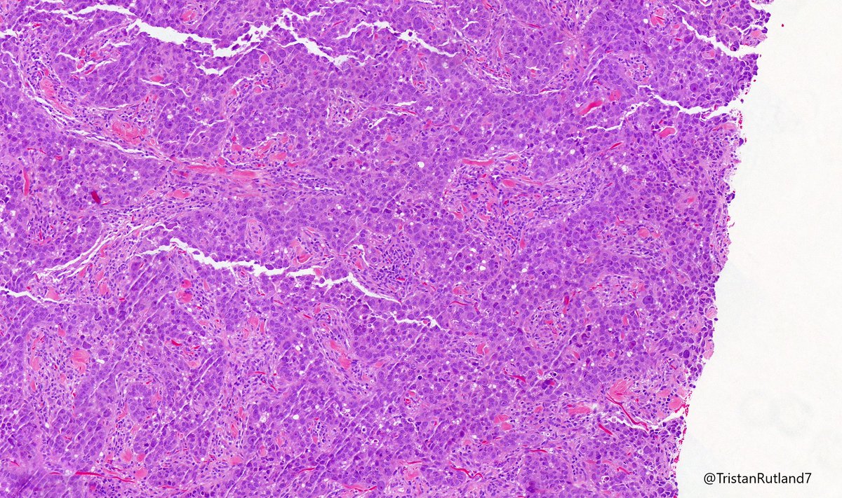 Tristan Rutland MBBS FRCPA IFCAP tweet media