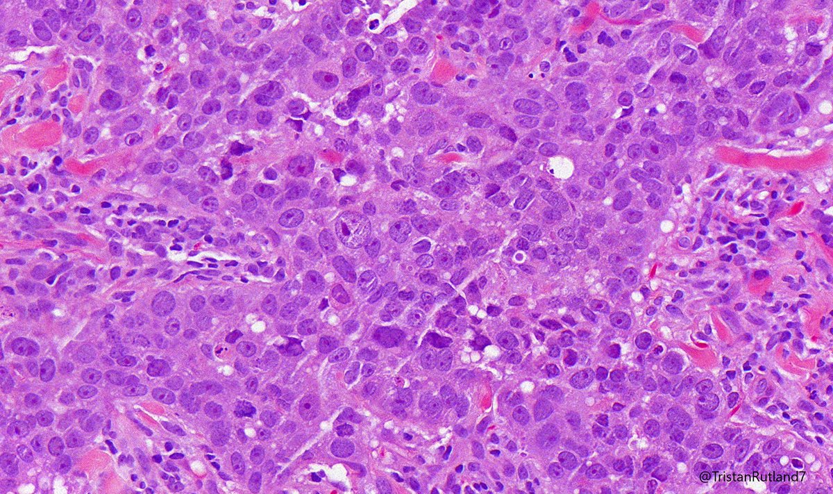 Tristan Rutland MBBS FRCPA IFCAP tweet media