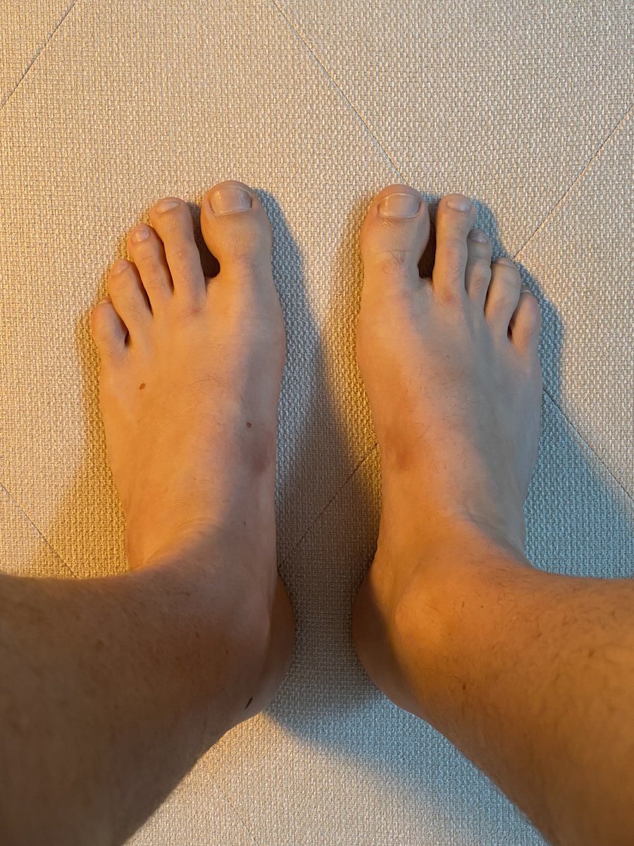 feettaps's tweet photo. 🛏️👣🦶GOOD MORNING FEETS! Slept in?🦶👣🛏️

FREE Onlyfans: https://t.co/AohKAVijFK

#cashfag #findom #financialdomination #finsub #cashmaster #paypig #cashslave #master #sub #onlyfanspromo #onlyfansFree #feetfethish #gay #BoysLove #love #footdom #gayfootfetish 
 #footjobandmodels https://t.co/NBqVGix4WL
