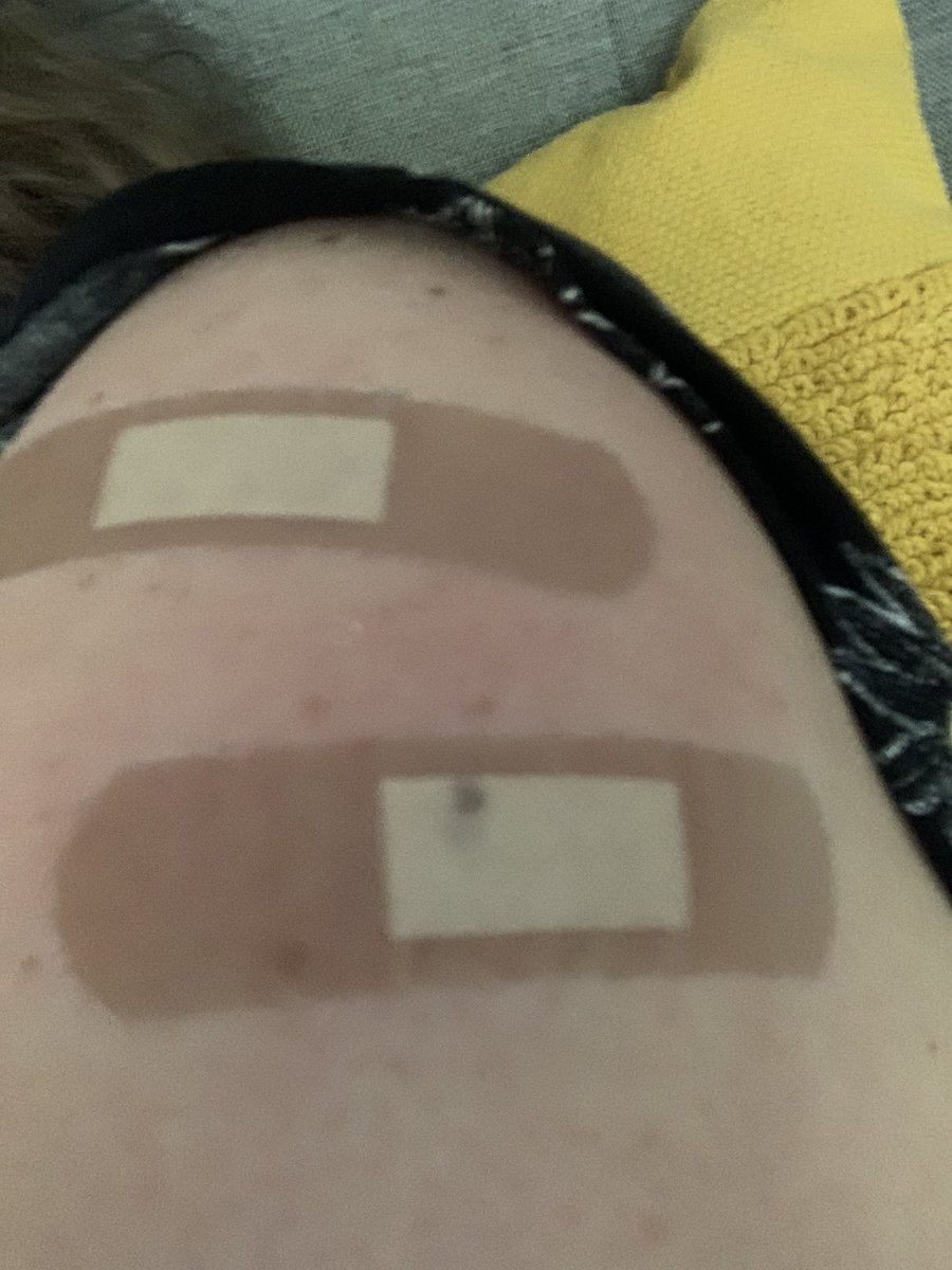barbaraca's tweet photo. A little red and a little sore. #worthit #notthisbitch #protecttheherd #BivalentBooster #flushottoo #ilovescience https://t.co/4TGWXAojRF