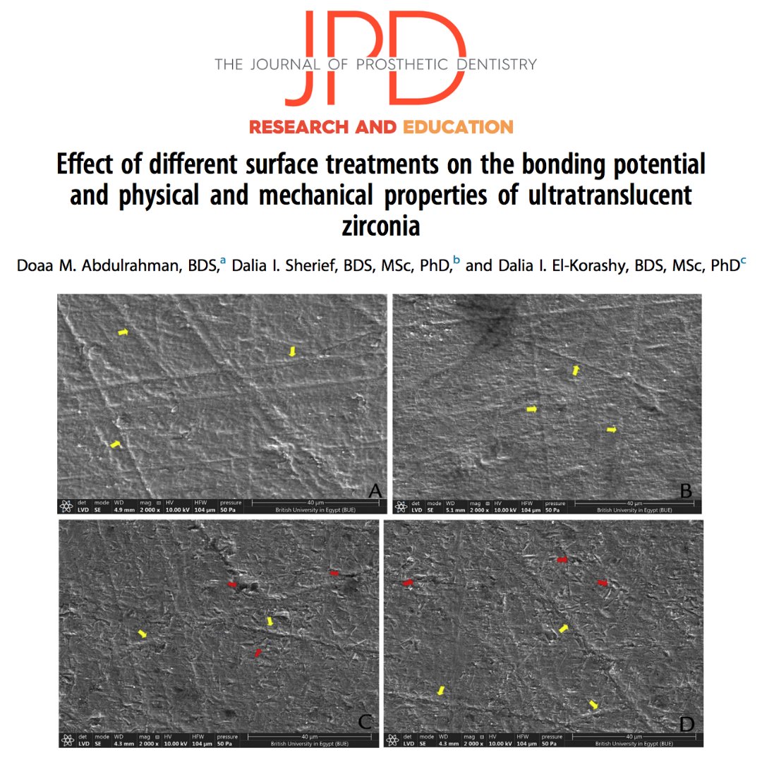 JPDentistry's tweet photo. This #invitrostudy from #theJPD evaluates how nonthermal oxygen plasma surface treatment might be appropriate for #anteriorrestorations made of ultratranslucent #zirconia. Learn more: https://t.co/vZjgTyYJwO https://t.co/WYE6UuU0qA