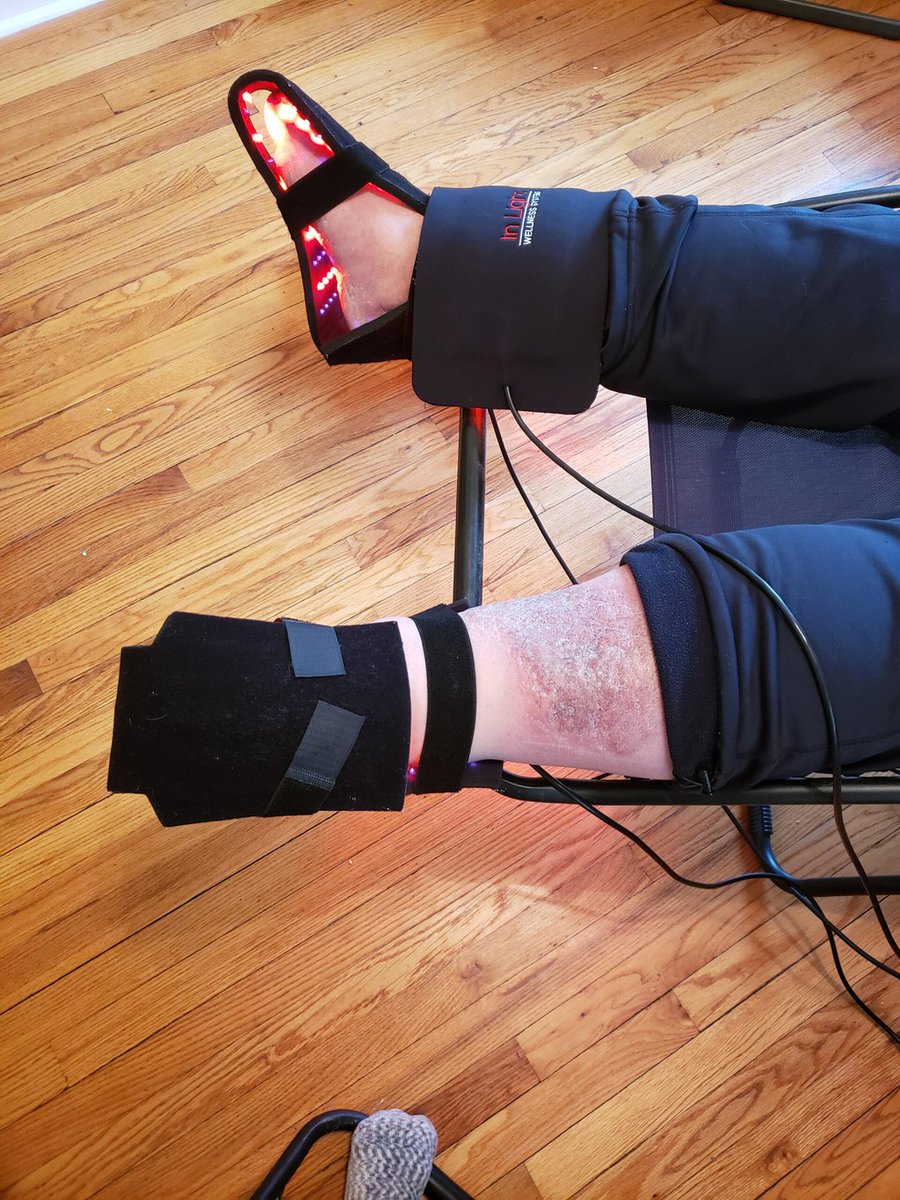 LearnAboutLight's tweet image. I love versatility in Light Therapy Pads
▸ bit.ly/3syLwvW

#LightTherapy #InLightTherapy #LLLT #Photobiomodulation