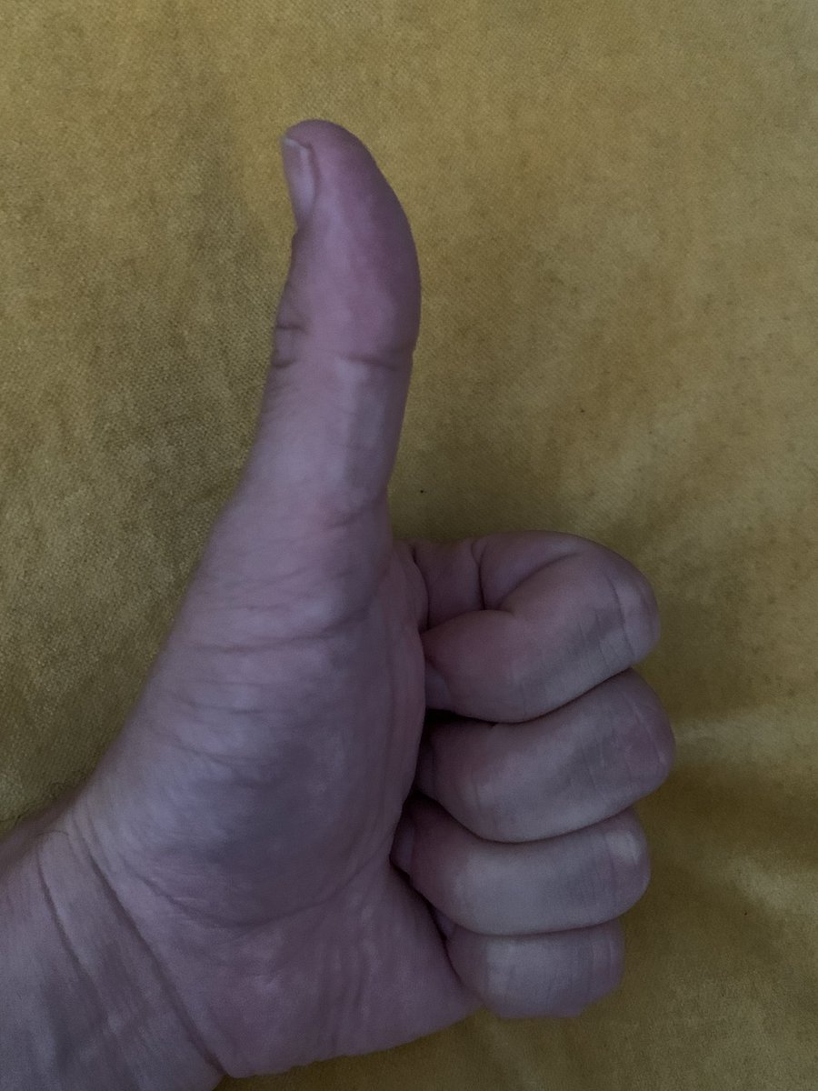 paperscout's tweet photo. Why does my thumb look so long?!?!
#digit #opposable #firstdigit #freecontent #pollex https://t.co/YEZ48Y0ZEc