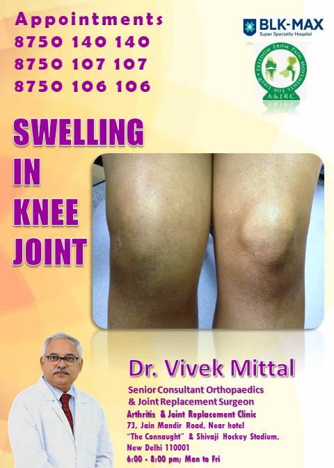 drvmortho's tweet photo. Arthritis & Joint Replacement Clinic
73, Jain Mandir Road, New Delhi 110001
Near hotel “The Connaught” & Shivaji Hockey Stadium,
6:00pm-8:00pm (Mon to Fri)
#bestkneereplacementsurgeonindelhi #sphdelhi #blkmax #fortishealthcare
#bestjointreplacementsurgeon
#bestdoctorindelhi https://t.co/N4hf4o4Se1