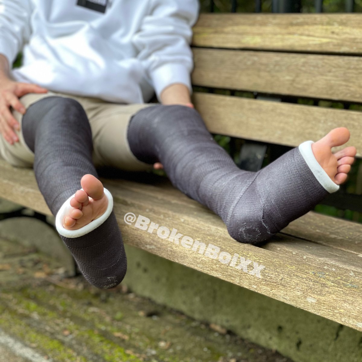 brokenbrosxx's tweet photo. DLLC fun in Stanley Park, Vancouver
#dllc #llc #legcast #legcasts #fulllegcasts #longlegcasts #longlegcast #doublelegcast #duallegcast #duallonglegcast #castedtoes https://t.co/FXOjuXqGlq