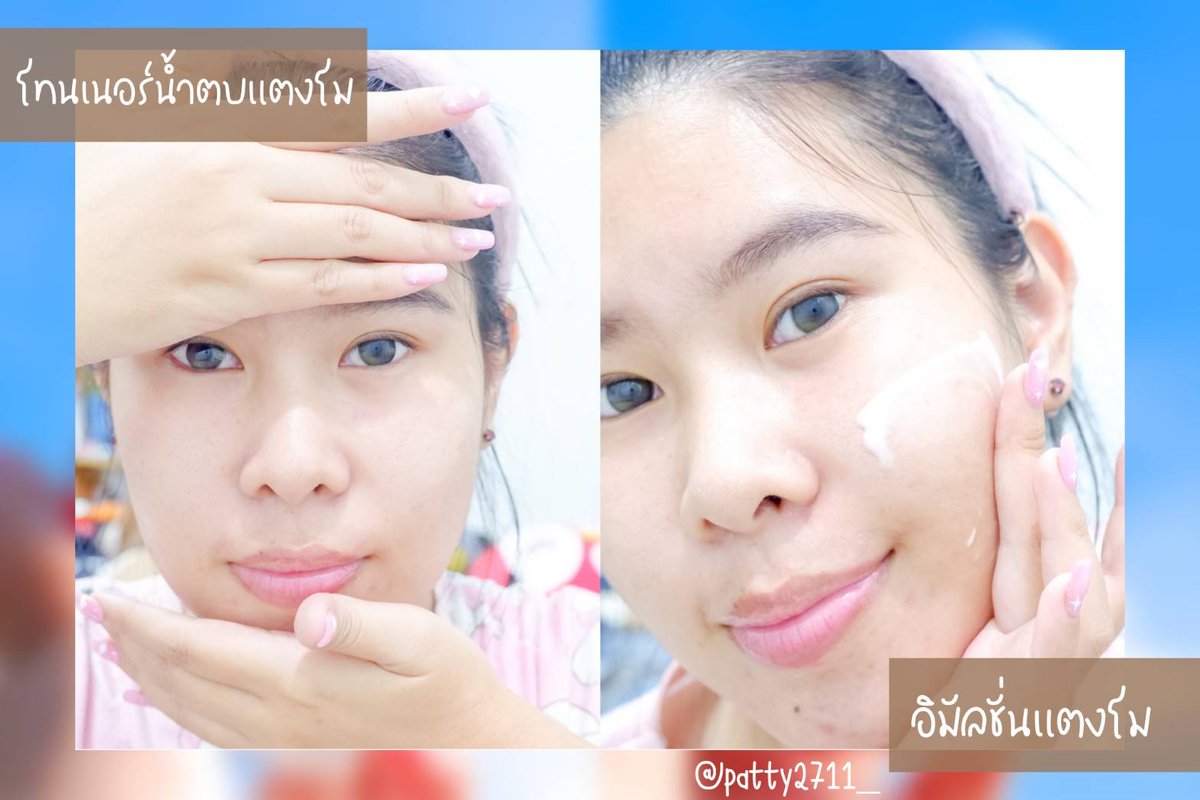Patty2711_'s tweet photo. ไม่ไหวไม่หยิบมาใช้คือทนความคิ้วท์ของ BTFarmskinโทนเนอร์น้ำตบและอิมัลชั่นแตงโม
คู่นี้คือเริ่ดมาก น้องช่วยกักเก็บความชุ่มชื้นให้กับผิวและช่วยควบคุมความมัน ไม่เหนอะหนะผิว ไม่มีสารที่ก่อให้เกิดการระคายเคืองเค้าชอบมากๆ แพคเกจก็น่ารักสุดๆแนะนำเลยค่ะ
#โทนเนอร์น้ำตบแตงโม #อิมัลชั่นแตงโม https://t.co/iYKxjjPlgl