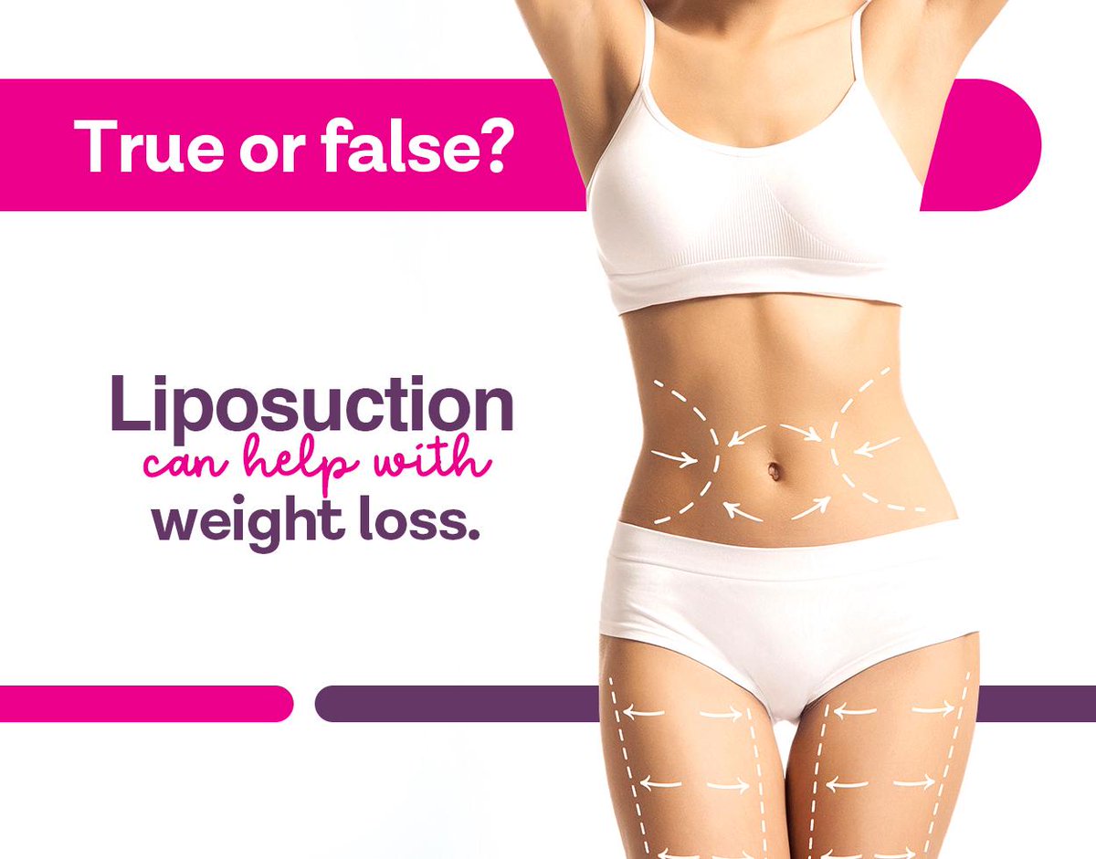 PerfectSkinMD's tweet image. False. At Perfect Skin MD, we routinely and safely remove 1-5 liters of fat with tumescent liposuction without general anesthesia. Visit perfectskinderm.com to view our before and after photos.