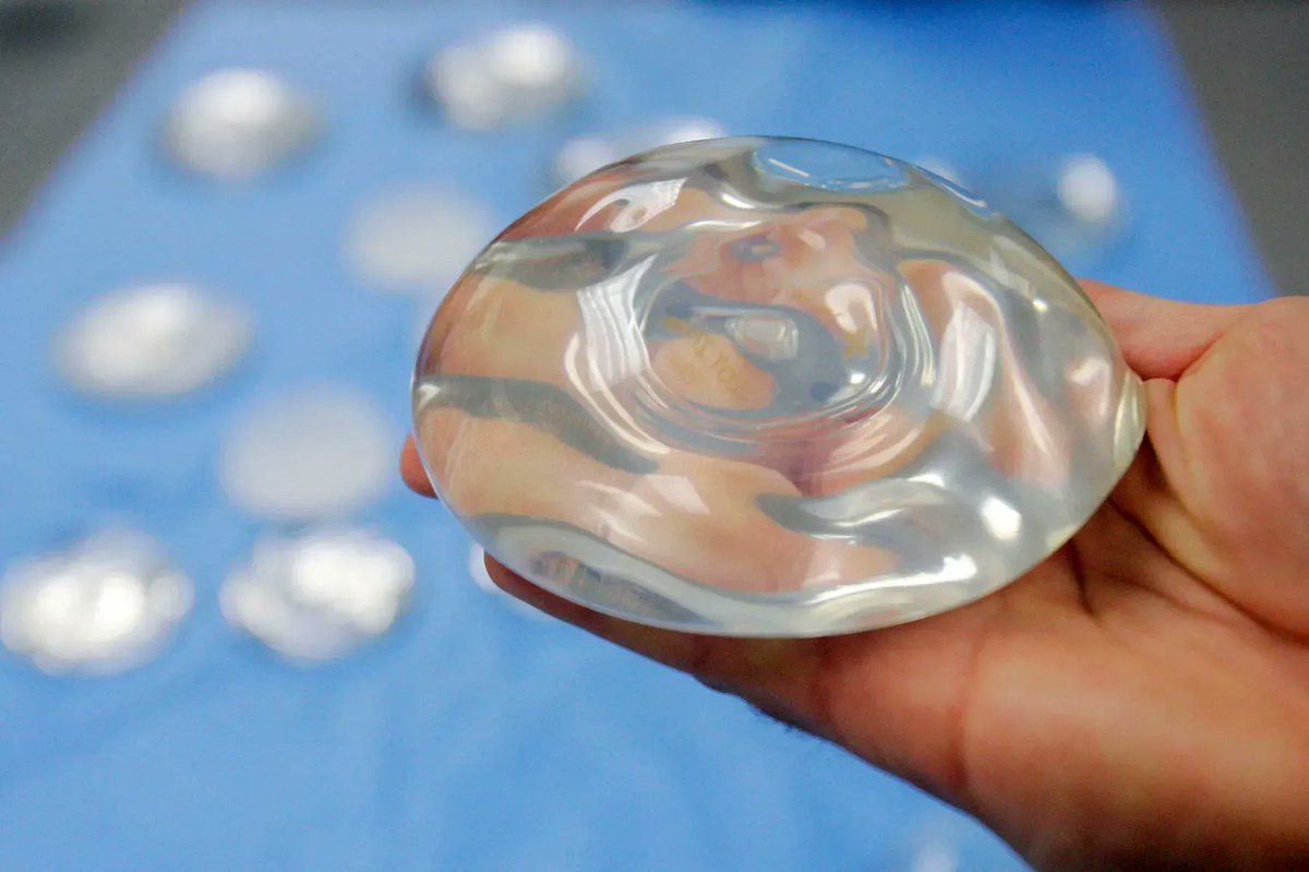 drchrysopoulo's tweet photo. Update from #FDA on #BreastImplant safety: reports of rare squamous cell carcinoma and various lymphomas in capsule around #BreastImplants: https://t.co/sVJKSwHvFn #PlasticSurgery #ALCL @BreastAdvocate https://t.co/MVLHFD587n