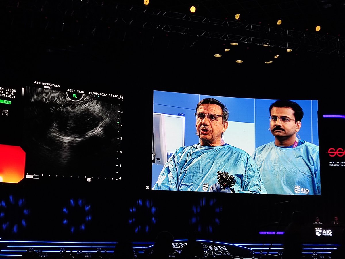 DharJahnvi's tweet photo. EUS-RFA of HCC caudate lobe... By Dr. Marc Gio.
@Jayanta_sam @DrLakhtakia
#ENDOCON 2022
@SGEIofficial @AIGHospitals https://t.co/v67bxvXpL0