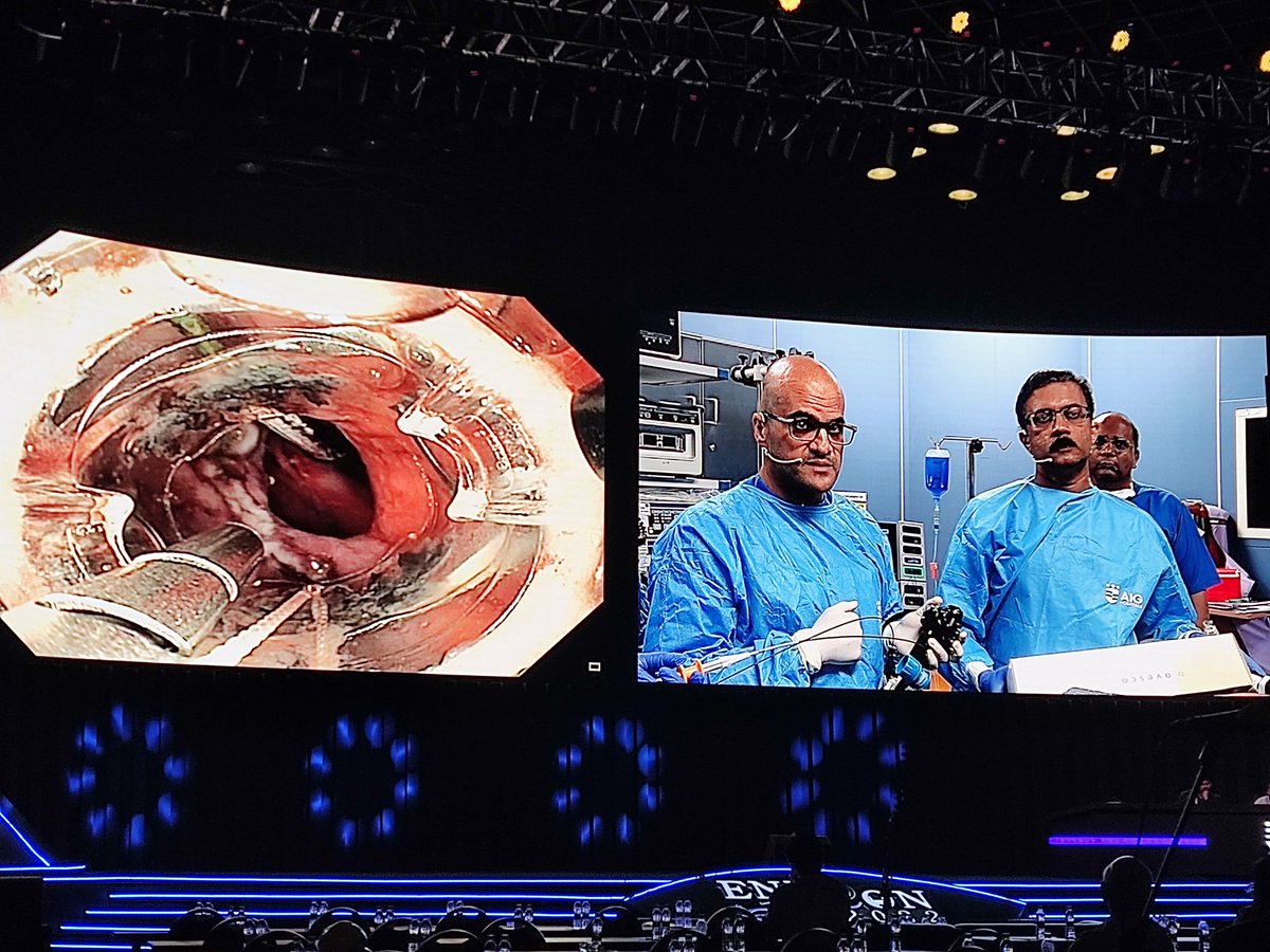 DharJahnvi's tweet photo. BARS (Bariatric anastomotic reduction system) procedure...
First demo π
@babudayyeh @RakeshKalapala1
#ENDOCON 2022
@SGEIofficial @AIGHospitals https://t.co/vOQUGbqGMy
