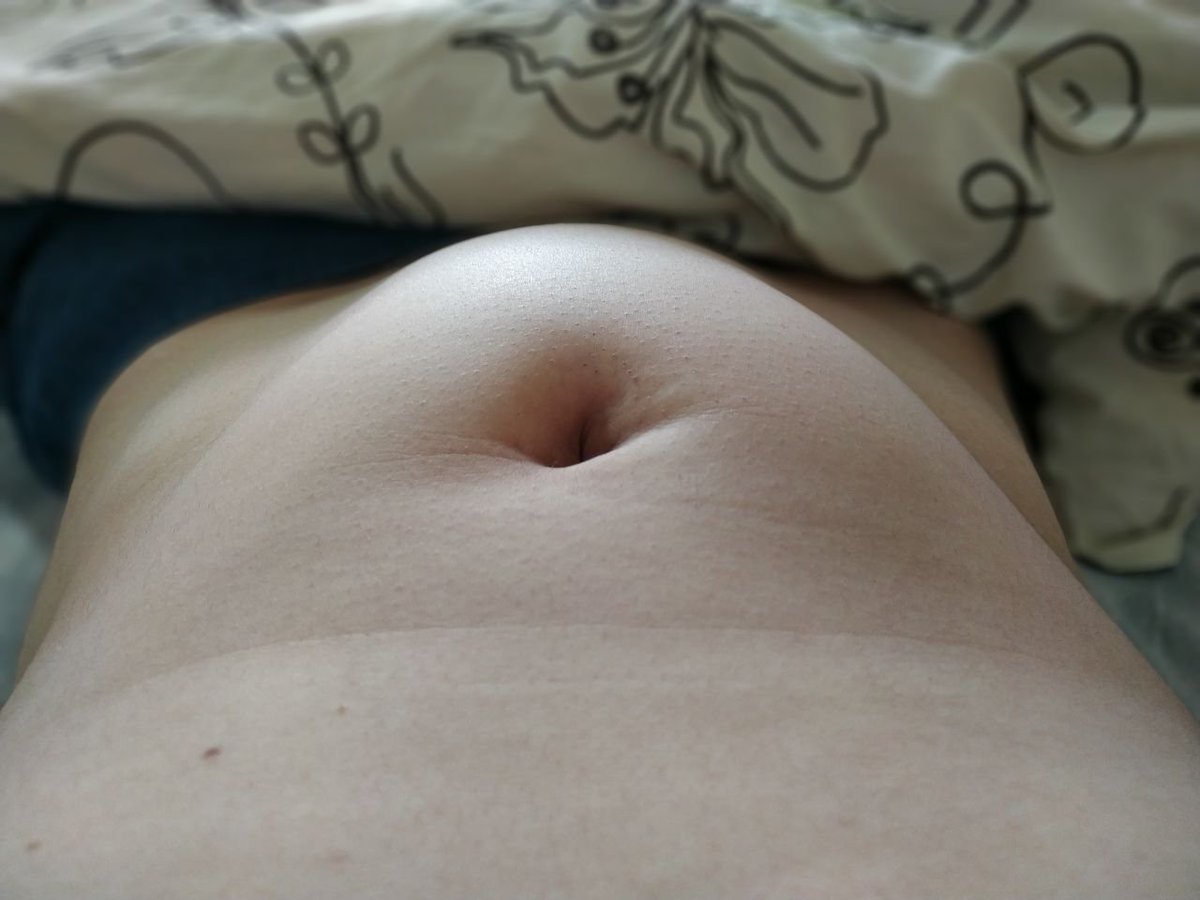 BBulges888's tweet photo. I have already drank about 2 liters of tea, all the liquid very quickly falls into my bladder, it feels like 1600-1700ml
#bladderbulge #fullbladder #bulgingbladder #swollenbladder #pee https://t.co/qJwrwqzdYV