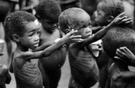ChifeDr's tweet photo. I was a child of the Biafra war.
I survived. I was lucky.
Two million children like me died.
(It’s called kwashiorkor, pls don’t look away) 
7/ https://t.co/ZGQQBJNzzA