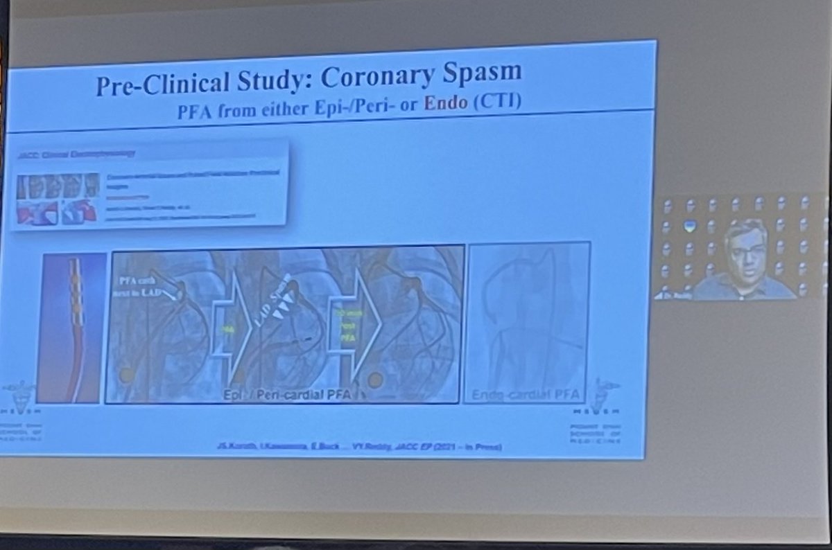 Lot of hype but important safety questions from ⁦@VivekReddyMD⁩ regarding PFA #CAHRS2022 #epeeps Just accepted to #jaccep jacc.org/doi/10.1016/j.…