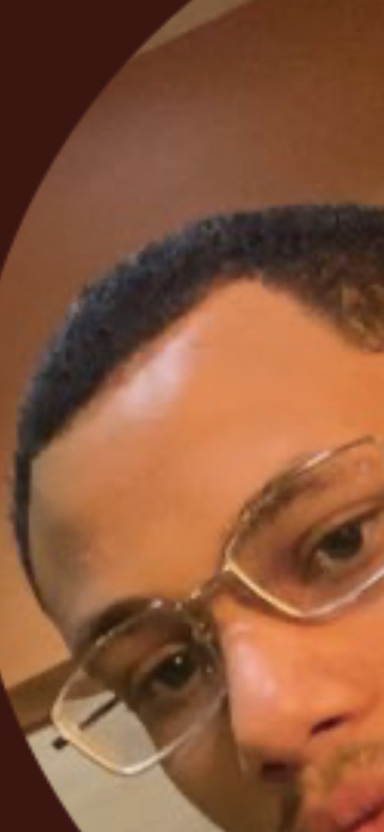 AdderallMonster's tweet photo. @yvngmajjj @3ethboi @MrJamesonNeat @sharth_2000 @feuenfeu My brother in Christ your head is mostly your forehead https://t.co/8DZWaSnYJi