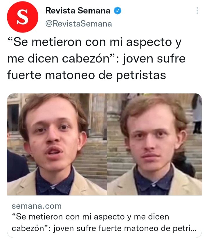 KIDOpedro's tweet photo. Papi no se rompa el coco con el matoneo... Nada, tenga la frente en alto y adelante. Es que a estos muchachos les cabe el país en la cabeza. https://t.co/SDXiADz3Bi