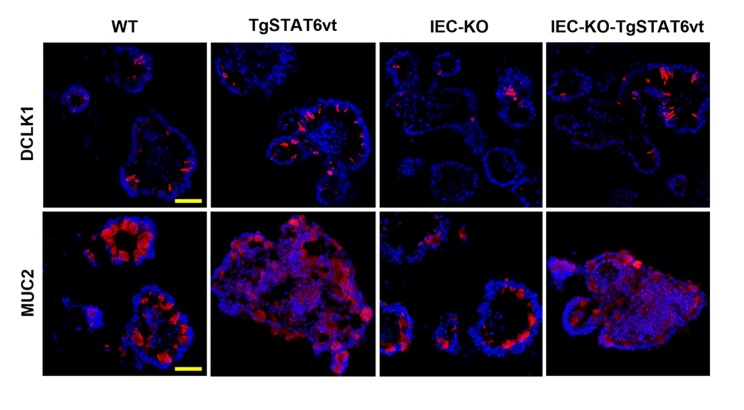Intestinal_Cell's tweet photo. A new @NatureComms study has shown that sirtuin 6 maintains epithelial STAT6 activity, supporting intestinal #TuftCell development and type 2 #immunity. 💡
📌 Learn more: https://t.co/GEFRdZxk1U https://t.co/kCjuBs9hDP