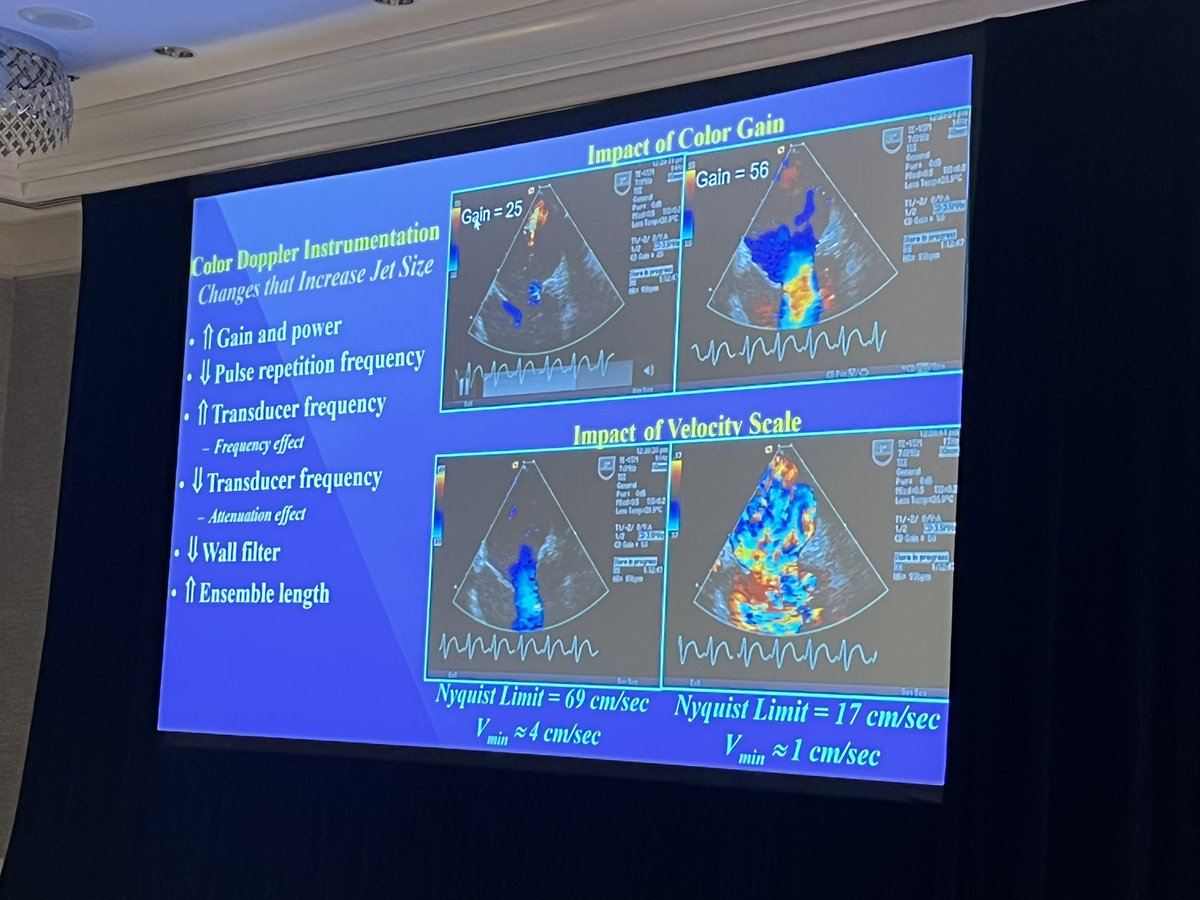 AkhilNarangMD's tweet photo. Physics still works! @JamesDThomasMD1 breaks down quantification of MR. Take home points: lots of ways to quantify severity, don’t settle for visual estimation using the tomato scale 🍅 #EchoNU #EchoFirst https://t.co/Td9TZ26gs5