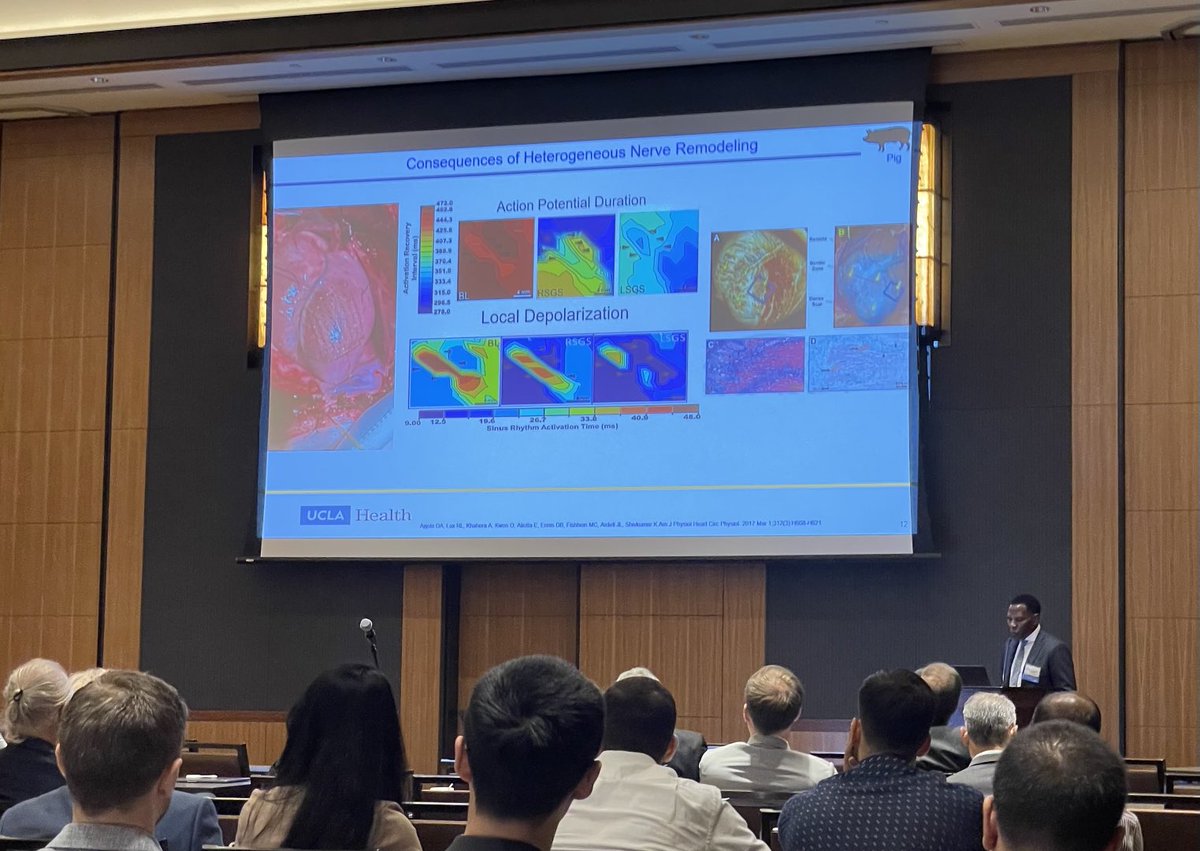 Stellar update on the role and therapeutic targets of the autonomic nervous system in ventricular arrhythmias by Dr. Olu Ajijola! A whirlwind tour of bench to bedside advances from a clinician scientist. Great stuff here at CA HRS #epeeps #CAHRS2022 #UCLAHealth