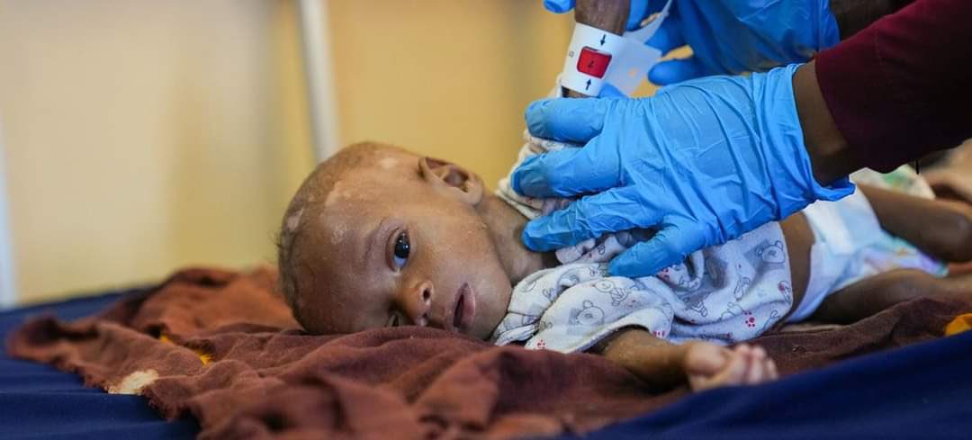 Abdirachiid's tweet photo. Finding a solution to the drought in Somalia is a collective responsibility for all of us. 
Our country must be prepared to adapt to climate change and be resilient to natural disasters that we will live with for a long time. 
#ClimateChangeChallenge . 
#Togetherwecanstand. https://t.co/cj1UoCILxA
