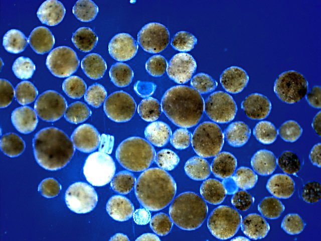 IVoltski's tweet photo. ‘Hadallogromia’ (c) Jan Pawlowski
– a #Monothalamid which really likes the Aleutian Trench abyss:
https://t.co/k0rbv6FpAp
~~~
#DeepSea #hadal #foraminifera #AleutBio https://t.co/XlhWX6vtjt