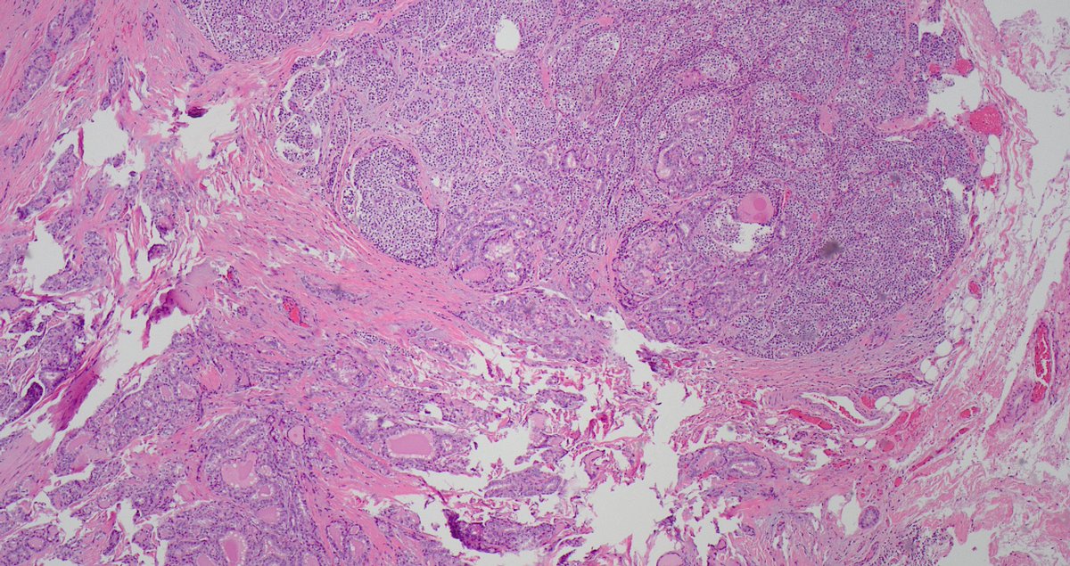 Signout Machine ⚙️ tweet media