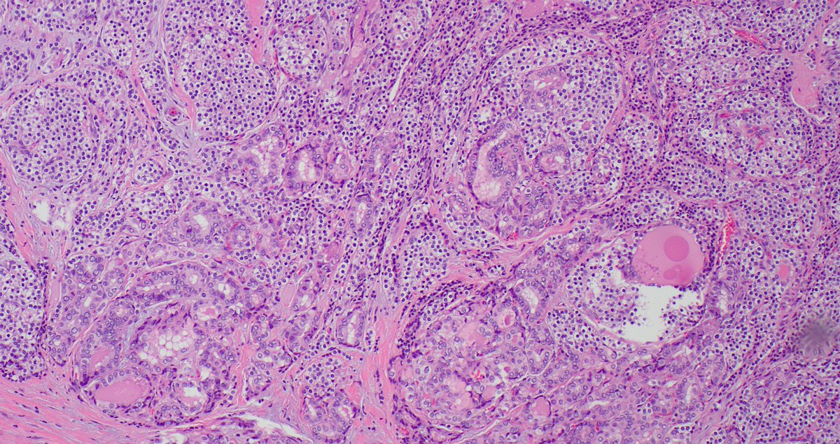 Signout Machine ⚙️ tweet media